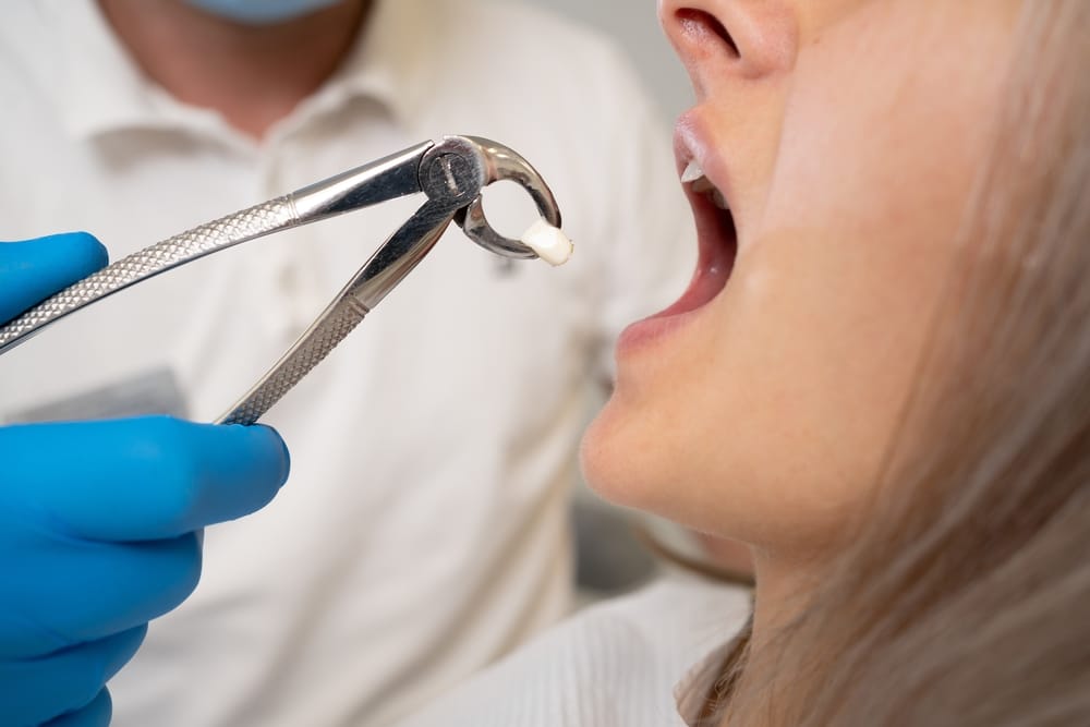 Woman having a Wisdom Teeth Removal in Columbus, Ohio